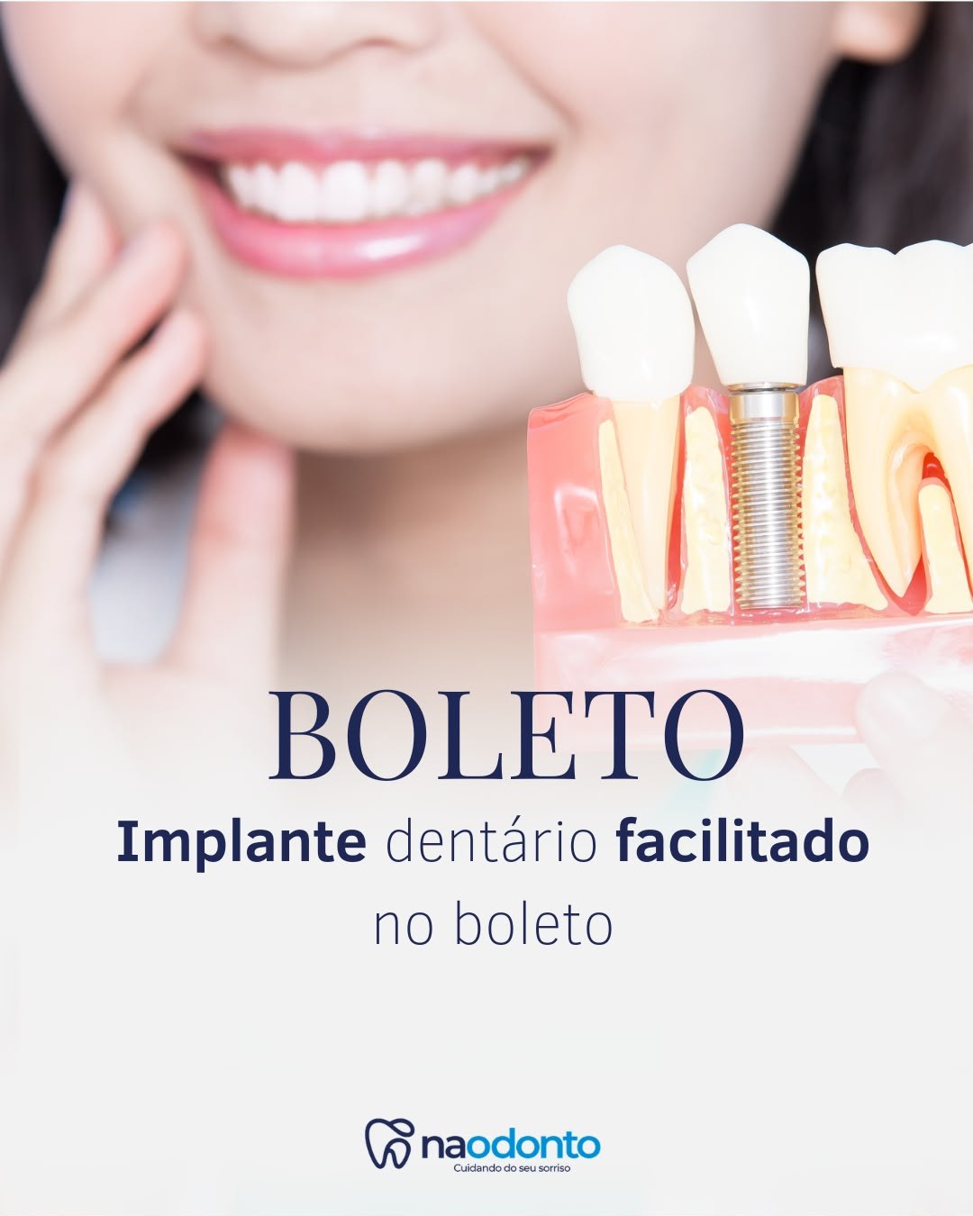 Implante dentário facilitado no boleto